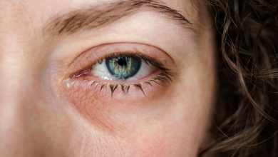 Bệnh đau mắt đỏ: Nguyên nhân, triệu chứng và cách điều trị